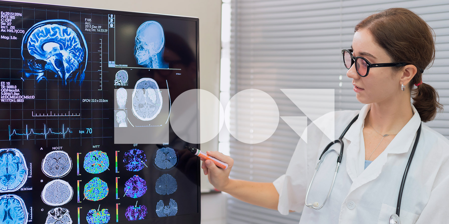 Proyecto EFIC: Ejercicio físico en personas con daño cerebral adquirido (ictus). Cátedra Deporte y Ejercicio Físico