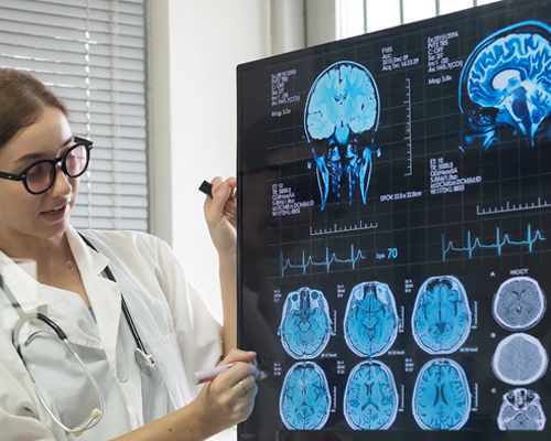 Proyecto EFIC: Ejercicio físico en personas con daño cerebral adquirido (ictus). Cátedra Deporte y Ejercicio Físico